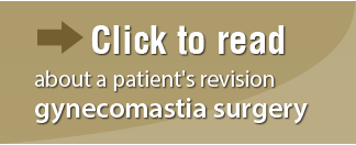 Click to read, about a patient's revision gynecomastia surgery