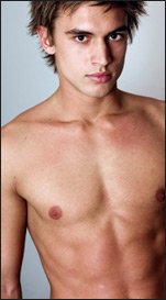 GYNECOMASTIA - Model (men)
