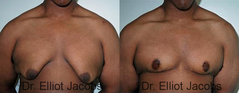 Large do areolas like men Scientists discover