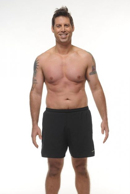 male breast reduction
