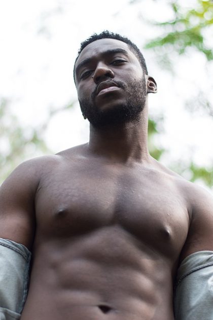 gynecomastia New York