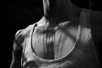 hyperhidrosis New York