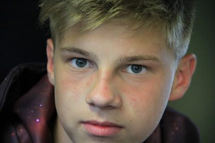 teen gynecomastia New York